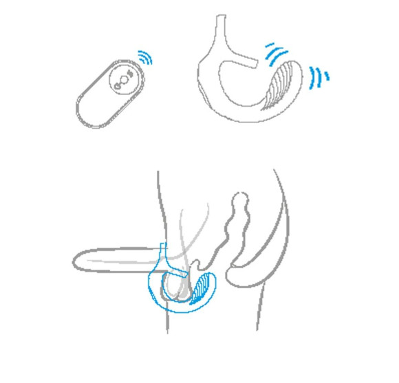 Черный анальный стимулятор с эрекционными кольцами Remote Couple Teaser Черный анальный стимулятор с эрекционными кольцами Remote Couple Teaser